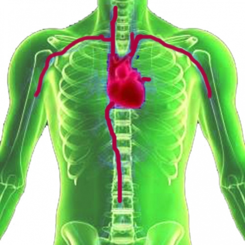 Estudo Genético ajuda a prevenir infarto